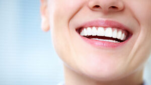Cuidado com os dentes - Happiness odontologia 